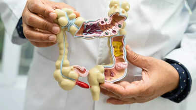 Appendix cancer on the rise: Understanding symptoms, causes, types, and more